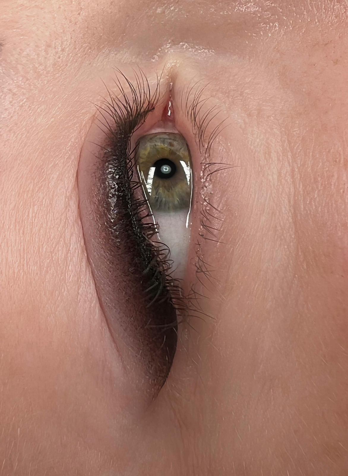 Wimpernkranzverdichtung